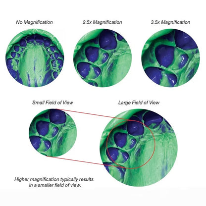 LUPAS DE MAGNIFICACIÓN PERIOPTIX